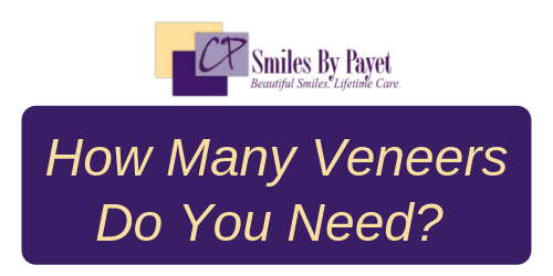 How many veneers do you need; Charlotte cosmetic dentistry