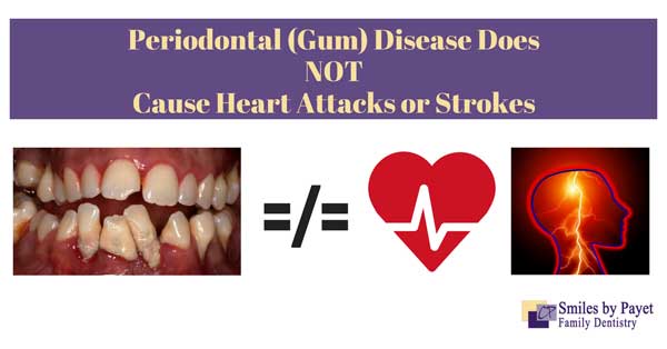 Charlotte dentist Dr. Payet says that gum disease does not cause heart attacks, strokes