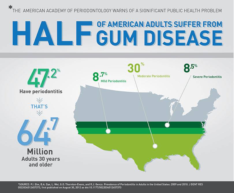 how many people have gum disease in the USA