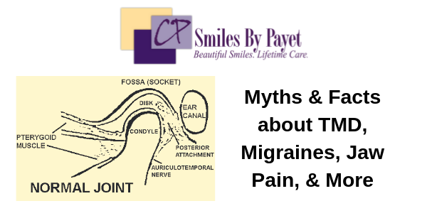 TMD, TMJ Myths & Facts