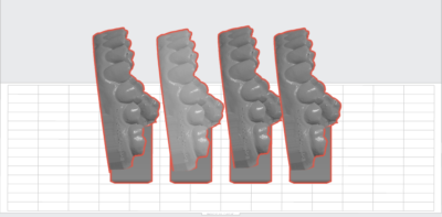 3D models by Charlotte dentist for affordable adult braces clear aligners