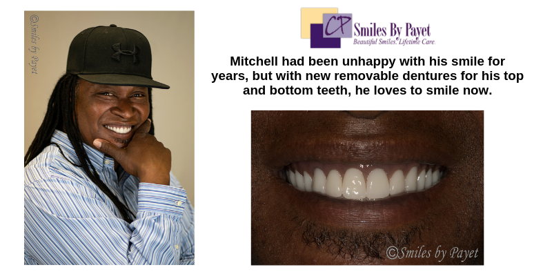 Removable Dentures Charlotte