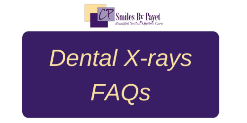 Frequently Asked Questions about dental x-rays