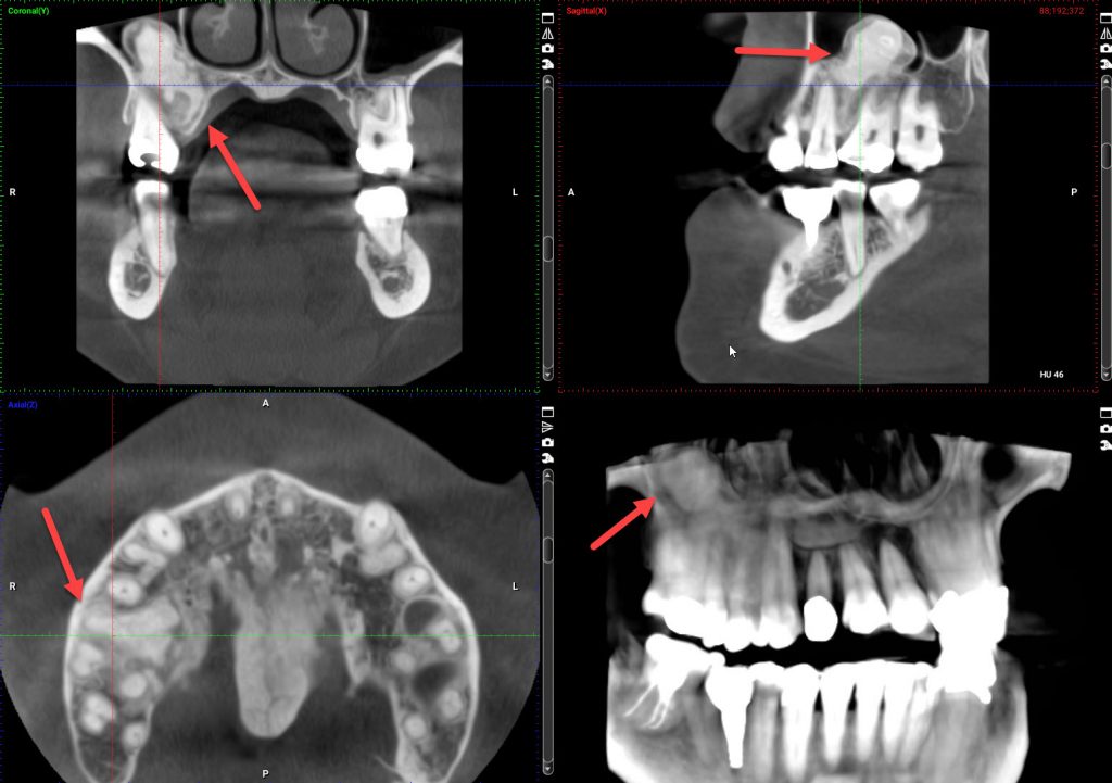 cone beam CT scan views