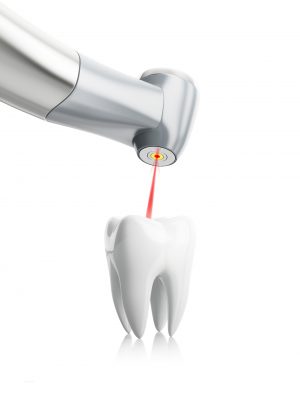 laser dentistry charlotte nc